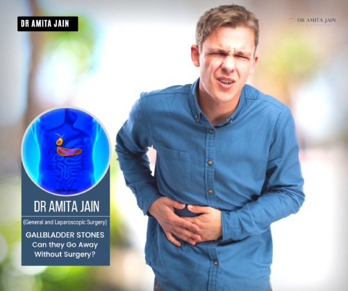 best gallbladder stone surgeon in Delhi Dr Amita Jain