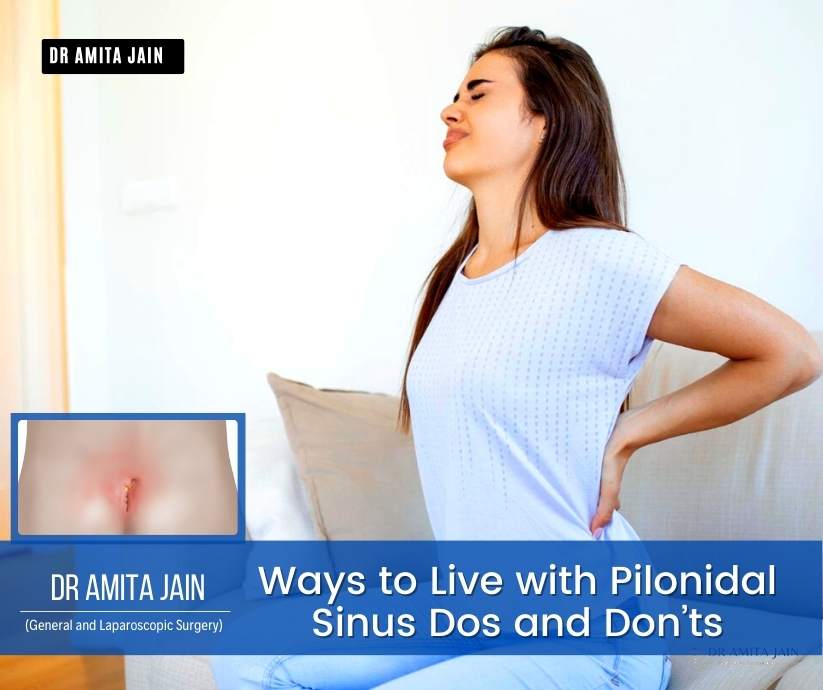 Ways to Live with Pilonidal Sinus - By Dr Amita Jain