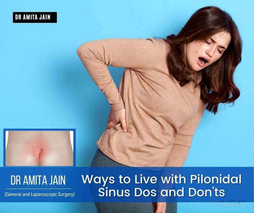Ways to Live with Pilonidal Sinus - By Dr Amita Jain