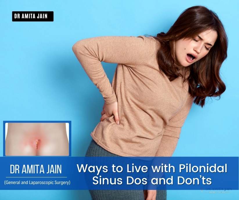 Living With Pilonidal Sinus- Things To Take Care Of - Pristyn Care