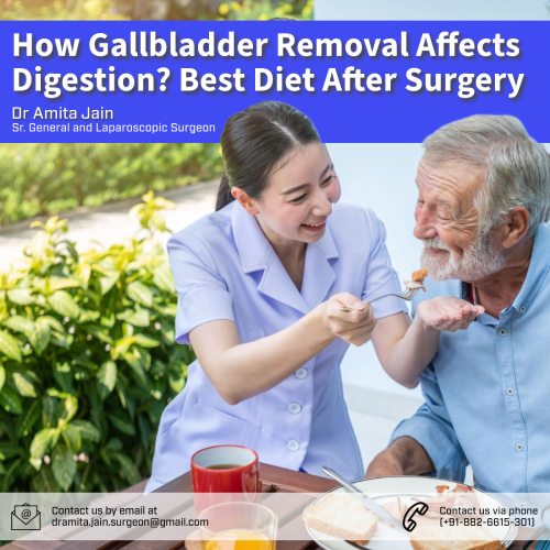 best gallbladder surgeon in Delhi