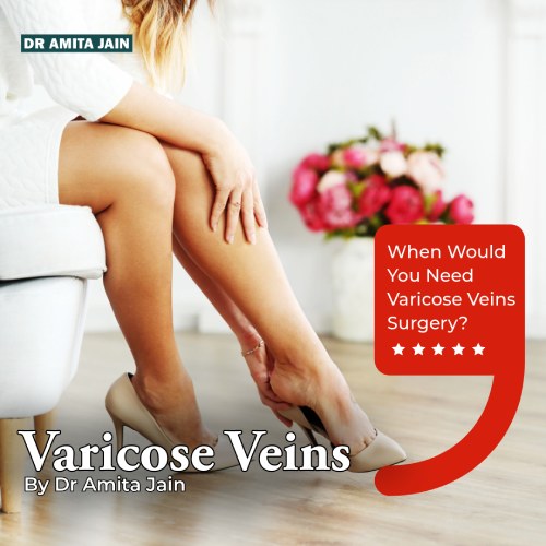 best varicose vein doctor in Delhi Dr AmitaJain