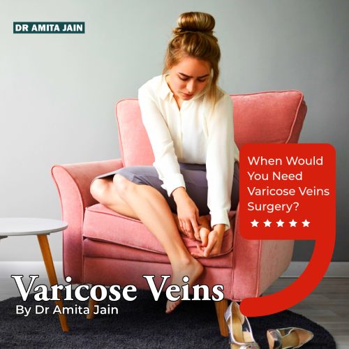 vericise vein doctor Dr Amita Jain