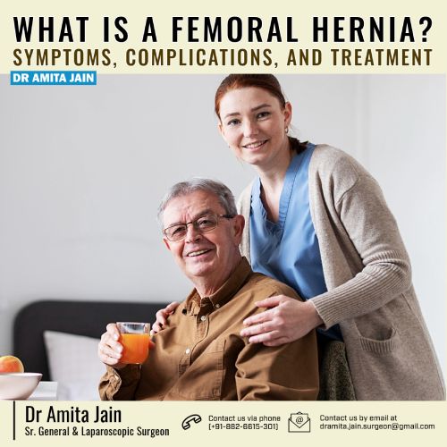 What is a Femoral Hernia? Symptoms, Complications, And Treatment