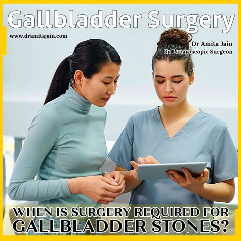 When is Surgery Required for Gallbladder Stones