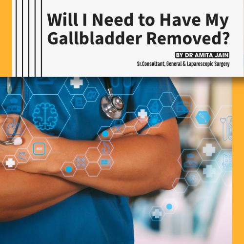 best gallbladder stone removal surgeon in Delhi
