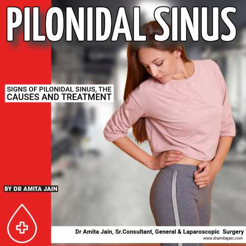Top surgeon for pilonidal sinus in delhi_dr. amita jain