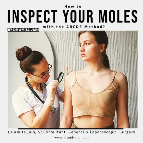 best laparoscopic surgeon in india_dr. amita jain