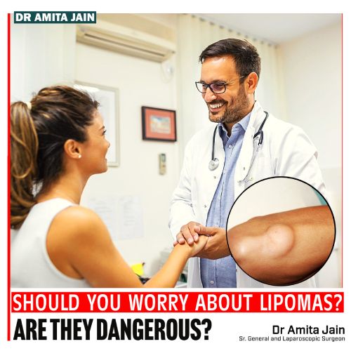 best surgeon for lipoma Dr Amita Jain