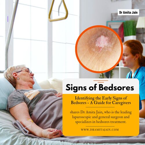 best bedsores doctor in Delhi Dr Amita Jain
