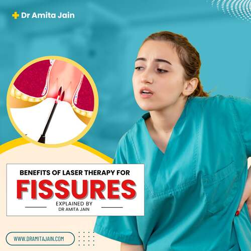 fissure surgeon blog image
