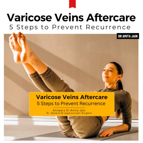 Best doctor for Varicose Veins Dr Amita Jain