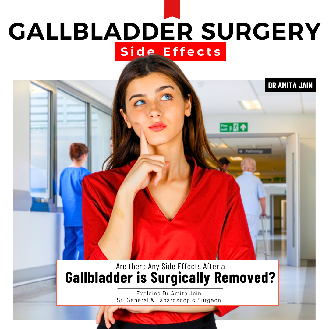 Dr Amita Jain Gallbladder Removal laparoscopic Surgeon