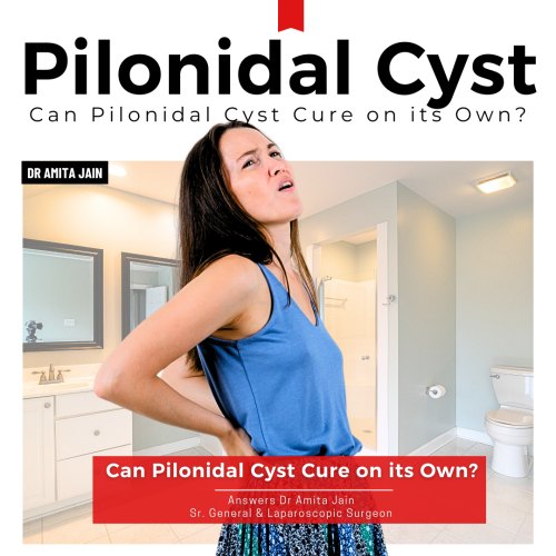 Pilonidal Cyst treatment by Dr Amita Jain
