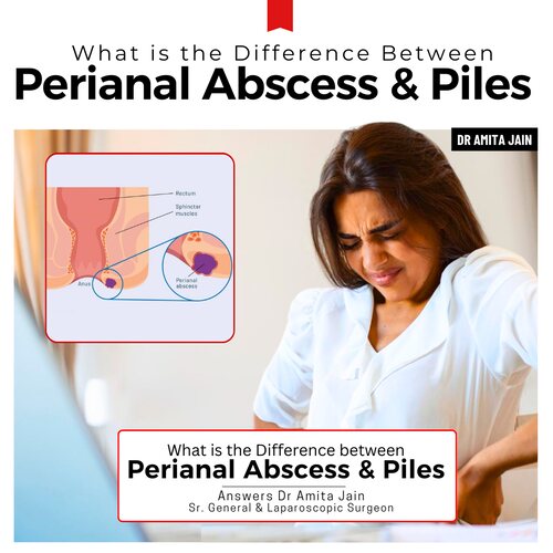 Dr Amita Jain best doctor and surgeon for Piles treatment