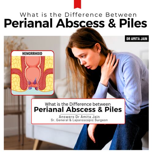 Dr Amita Jain best surgeon for Piles treatment in Delhi