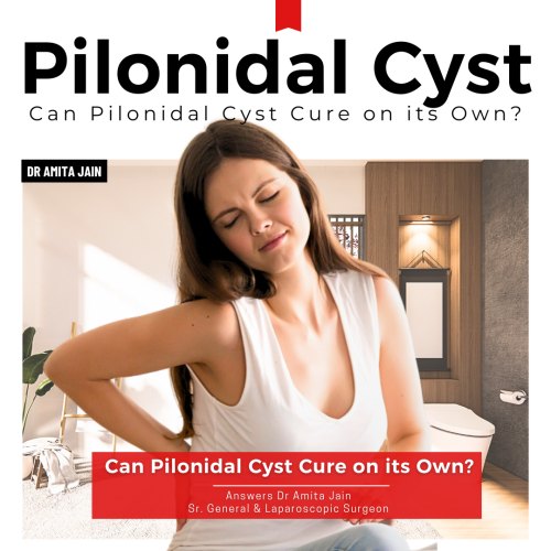 best doctor Surgeon for Pilonidal Cyst Dr Amita Jain