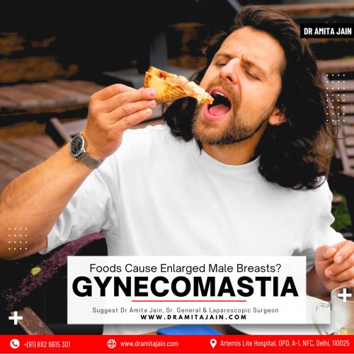 Dr Amita Jain Leading Surgeon for Gynecomastia Treatment in Delhi