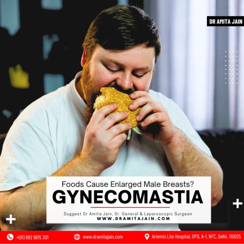 Dr Amita Jain Leading Surgeon for Gynecomastia Treatment in Delhi