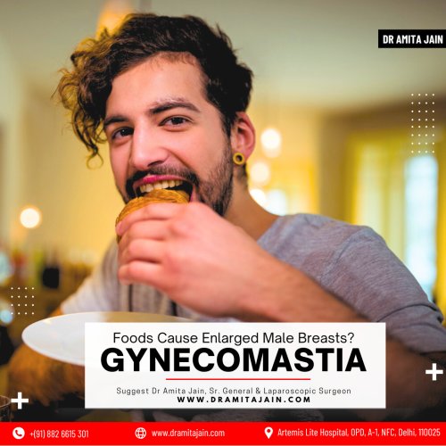 Dr Amita Jain Leading Surgeon for Gynecomastia Treatment in Delhi