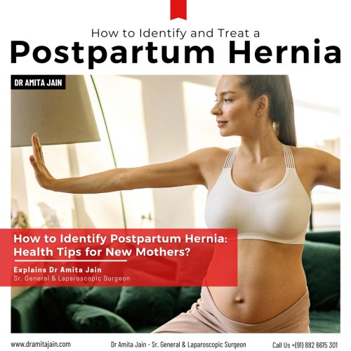 best surgeon for hernia treatment in Delhi Dr Amita Jain