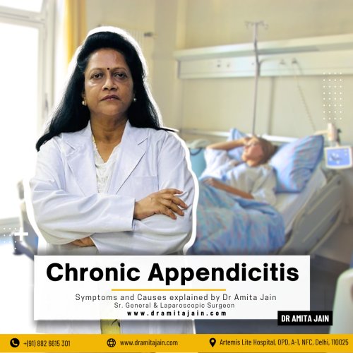 Dr Amita Jain best surgeons for appendicitis treatment in Delhi