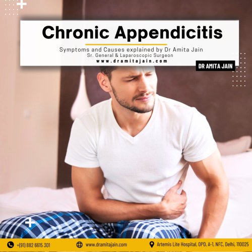 Dr Amita Jain, a leading laparoscopic surgeon and one of the top doctors and surgeons for appendicitis treatment in Delhi and India