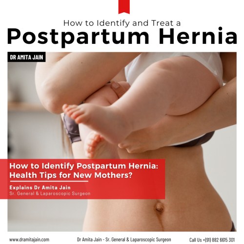 best surgeon for hernia treatment in Delhi Dr Amita Jain