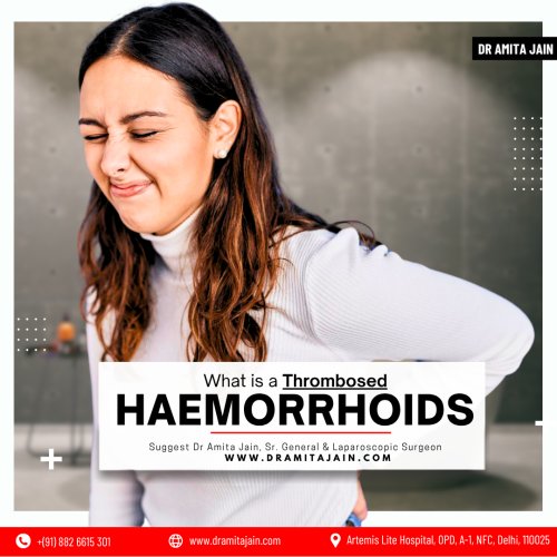 Dr Amita Jain best Surgeon doctor for piles treatment in Delhi India