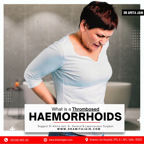 Dr Amita Jain best Surgeon doctor for piles treatment in Delhi India
