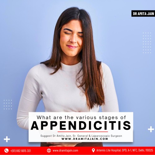 Dr Amita Jain, one of the best doctors and surgeons for appendicitis treatment in Delhi and India