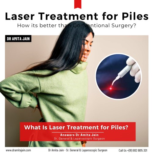 Best laser piles surgery in Delhi Dr Amita Jain