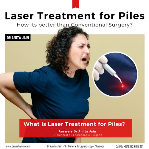 Best piles specialist doctor in Delhi and India Dr Amita Jain