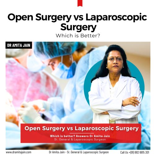 Dr Amita Jain Sr. General Surgeon for gallbladder stone removal