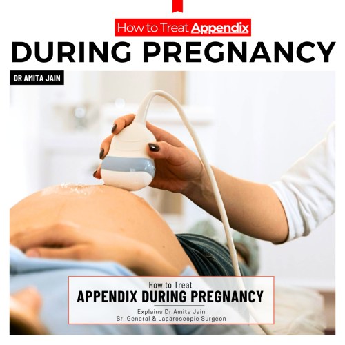 Dr Amita Jain speicalised surgeon for appendix treatment in Delhi