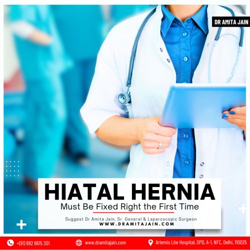 Dr Amita Jain best hernia treatment surgeon in Delhi 