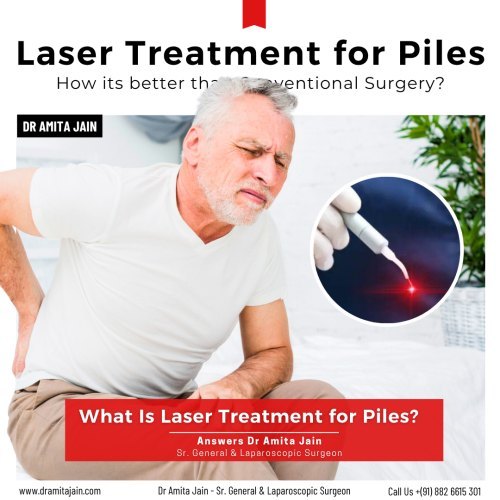 painless laser piles surgery in Delhi by Dr Amita Jain