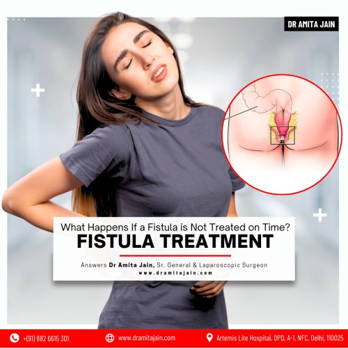 https://www.dramitajain.com/doctor-surgeon-for-Fistula-treatment-Delhi.html