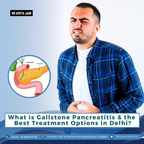 Dr Amita Jain best gallbladder stone removal surgeon in Delhi