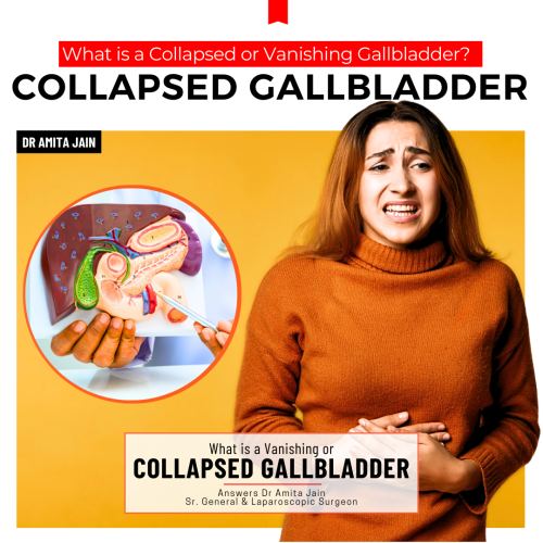 treatment for vanishing gallbladder by Dr Amita Jain