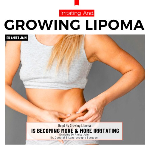 Dr Amita Jain one of the eminent doctors for lipoma treatment in Delhi