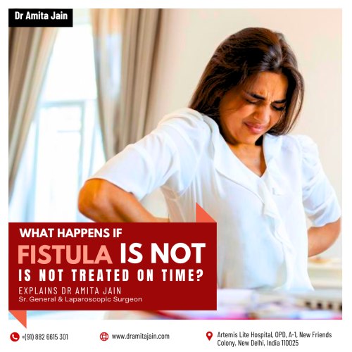 Top fistula surgeon Dr Amita Jain Senior General laparoscopic surgeon