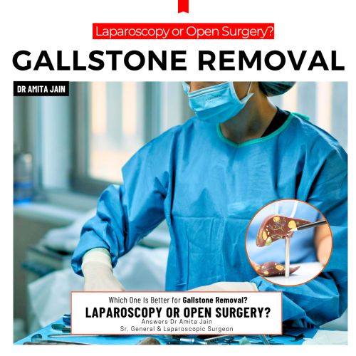best galllstone removal surgeon Dr Amita Jain