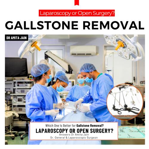 best galllstone removal surgeon Dr Amita Jain