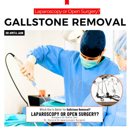 best galllstone removal surgeon Dr Amita Jain