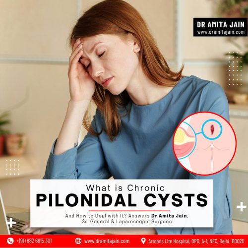 Pilonidal Sinus treatment by Dr Amita Jain Senior General and Laparoscopic Surgeon