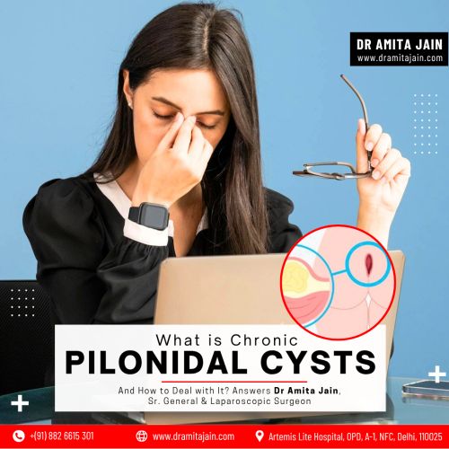 best Pilonidal Sinus treatment in Delhi by Dr Amita Jain Senior General and Laparoscopic Surgeon 