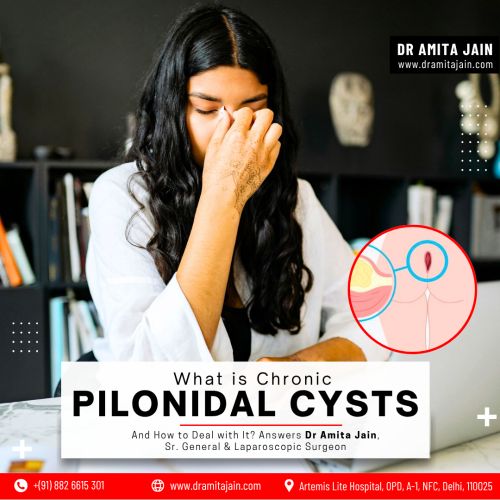 best Pilonidal Sinus treatment in Delhi by Dr Amita Jain Senior General and Laparoscopic Surgeon 
