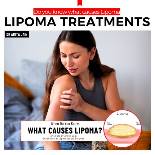 best lipoma surgeon in delhi_dr amita jain