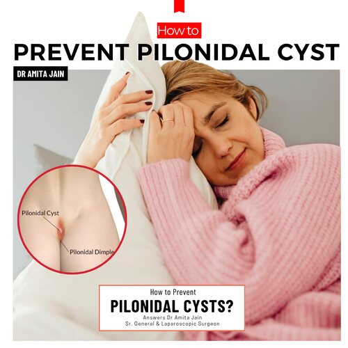 india's top doctor pilonidal sinus and cyst_dr amita jain